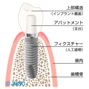 【写真】